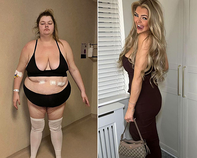 Místo koupě domu zatočila s obezitou. Lidé ji mají za dvojnici Margot Robbie